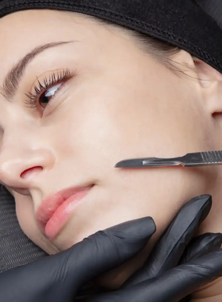 Dermaplaning procedure
