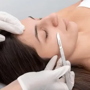 Dermaplaning service
